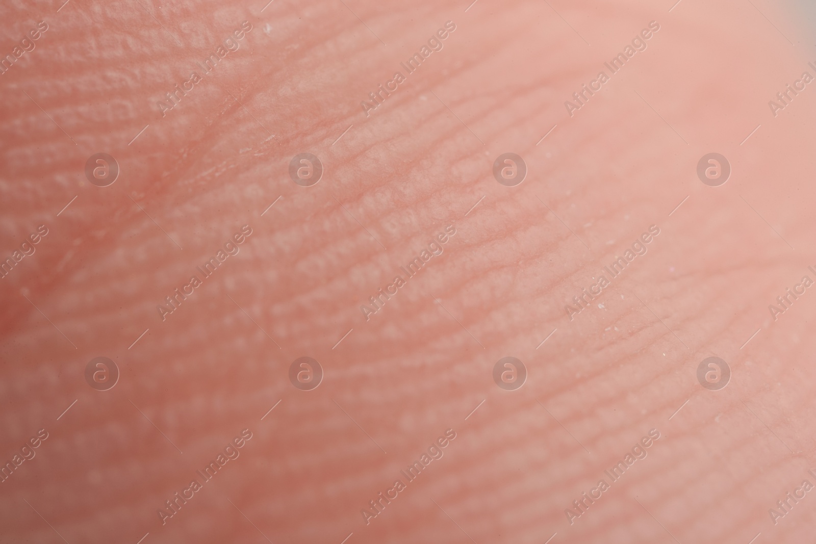 Photo of Texture of dry skin as background, macro view