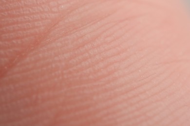 Texture of dry skin as background, macro view