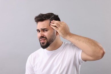 Photo of Emotional man with dandruff in his dark hair on light grey background