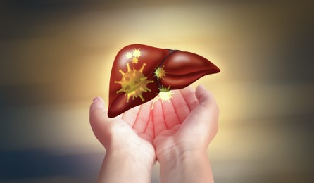 Woman and illustration of unhealthy liver on color background. Viral hepatitis
