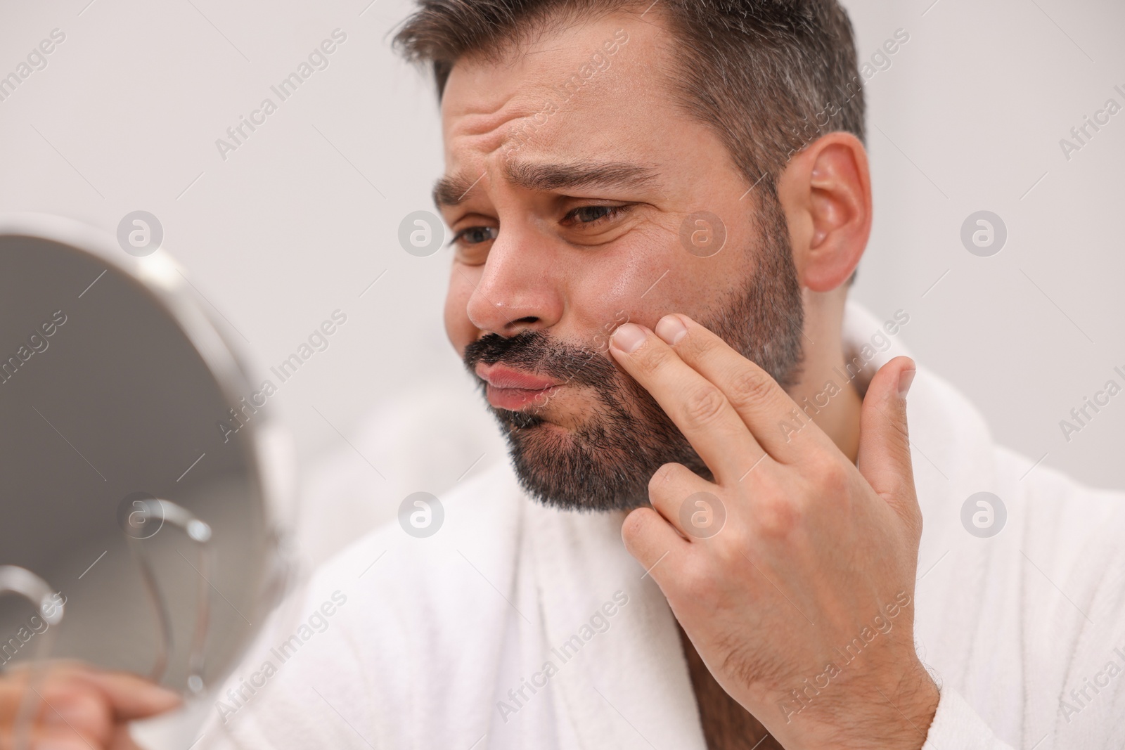 Photo of Confused man with skin problem looking at mirror indoors