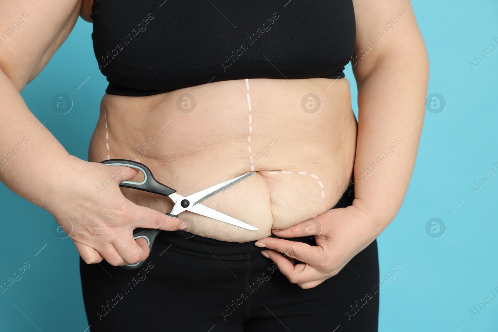 Photo of Obese woman with scissors and marks on body against light blue background, closeup. Weight loss surgery