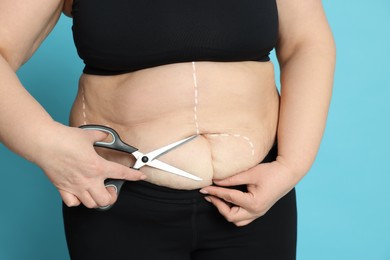 Obese woman with scissors and marks on body against light blue background, closeup. Weight loss surgery