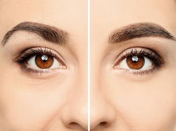 Image of Woman before and after eyebrow correction, closeup