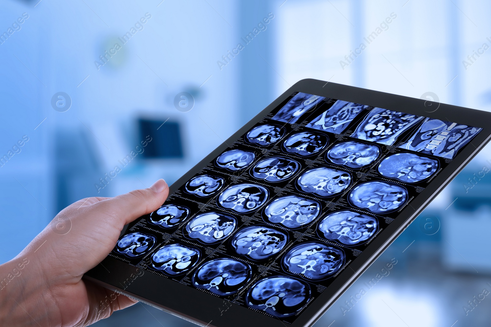 Image of Doctor examining x-ray images on tablet indoors, closeup