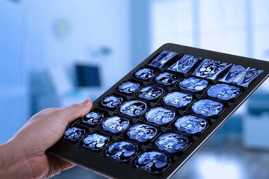 Doctor examining x-ray images on tablet indoors, closeup