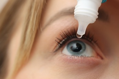 Photo of Young woman using eye drops, closeup view