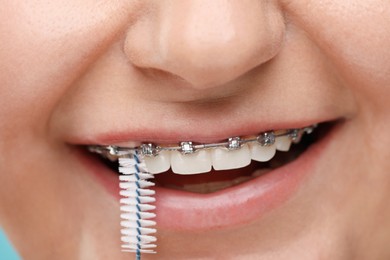 Photo of Woman with dental braces cleaning teeth using interdental brush, closeup
