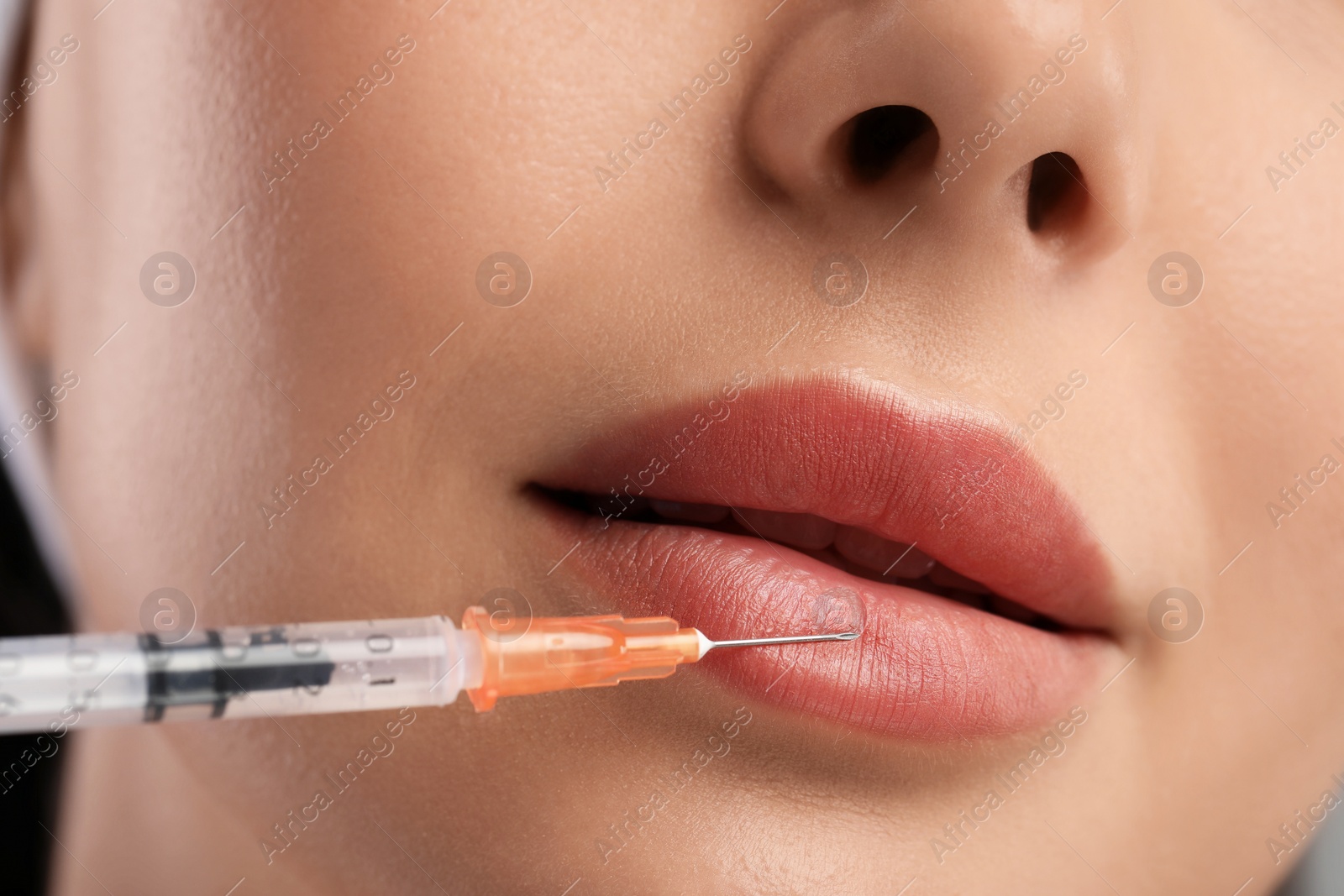 Photo of Young woman getting lips injection, closeup. Cosmetic surgery