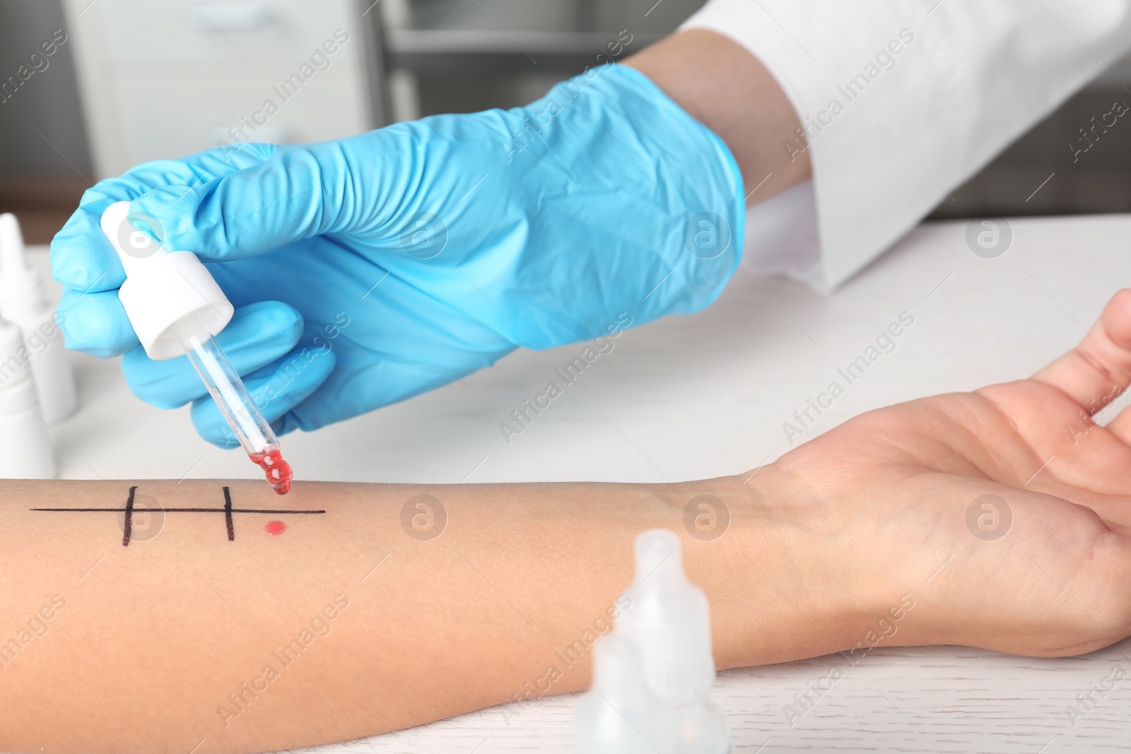 Photo of Doctor making allergy test at table, closeup