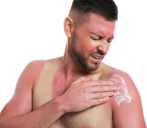 Photo of Man applying cream on sunburn against white background