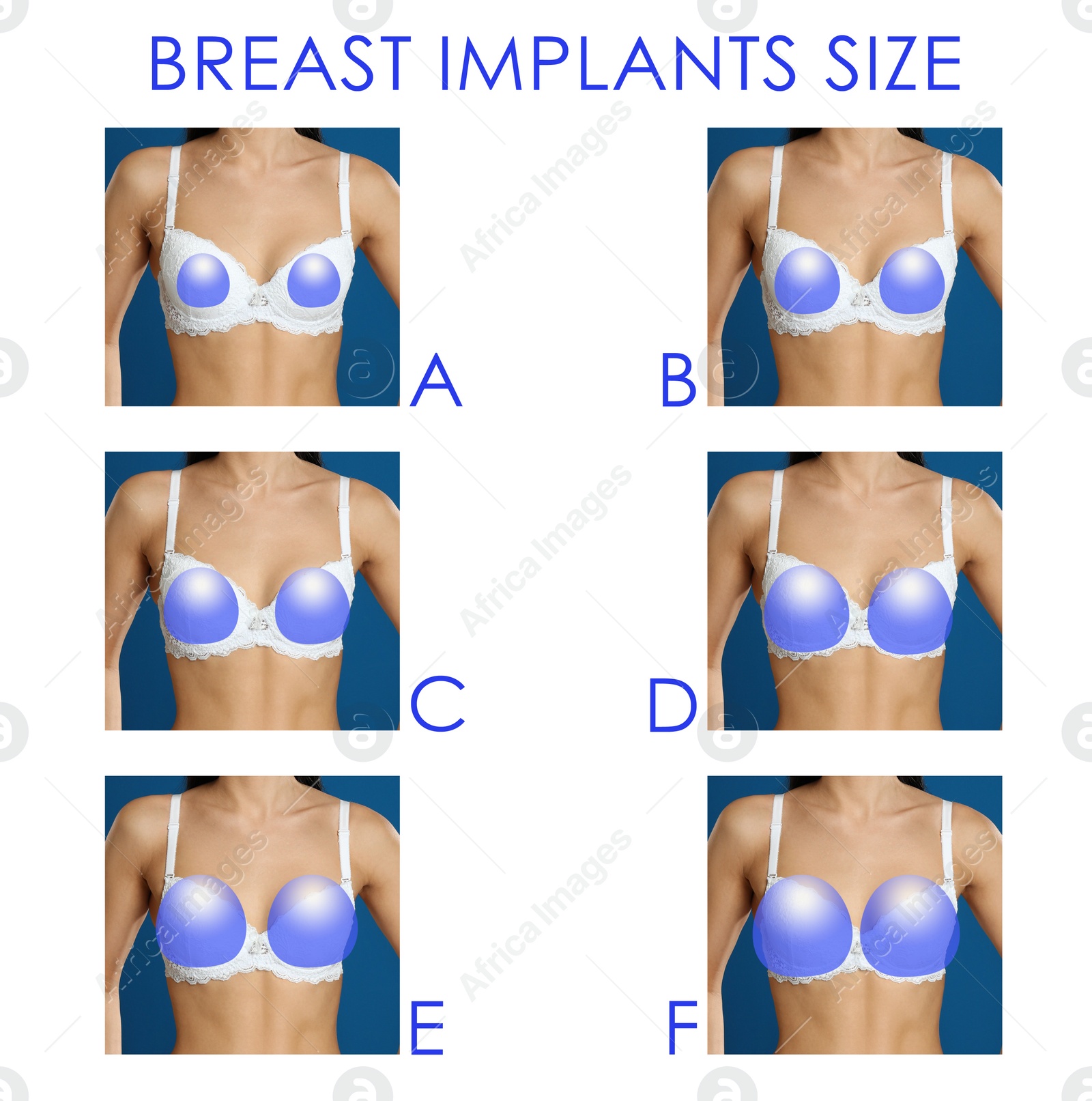 Image of Collage with photos of woman demonstrating different implant sizes for breast on white background, closeup