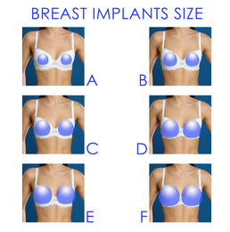 Image of Collage with photos of woman demonstrating different implant sizes for breast on white background, closeup