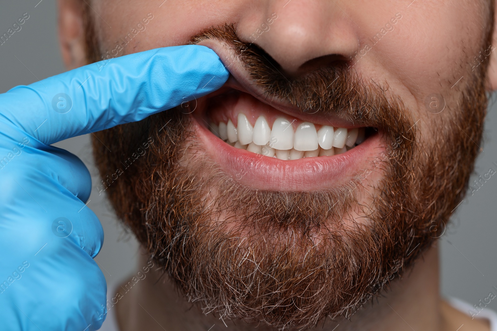 Photo of Man showing healthy gums on gray background, closeup