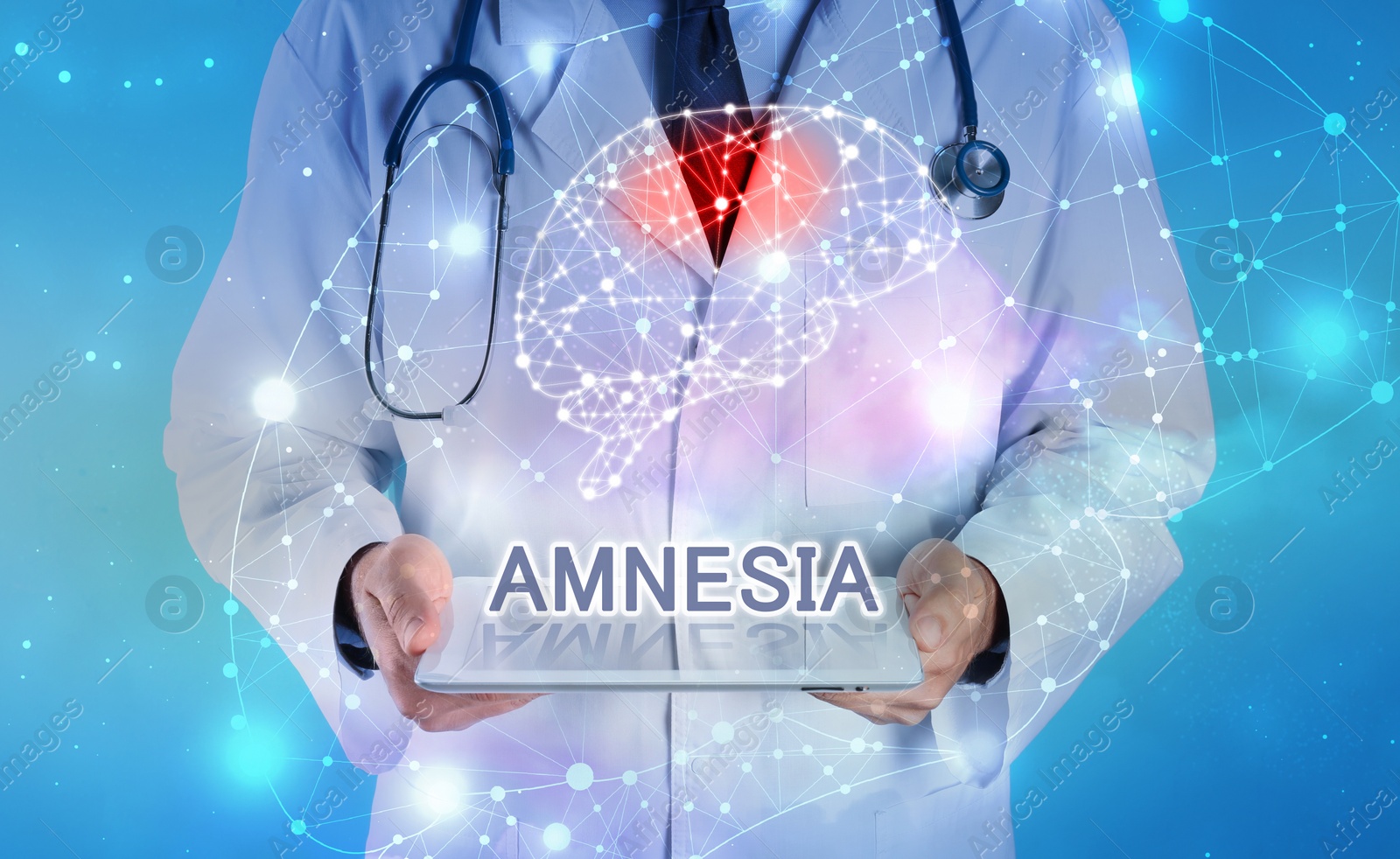 Image of Amnesia therapy. Illustration of human brain and doctor with tablet on light blue background, closeup