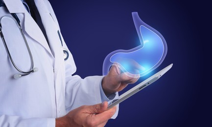 Symptoms and treatment of heartburn and other gastrointestinal diseases. Doctor using tablet on blue background, closeup. Stomach illustration over device