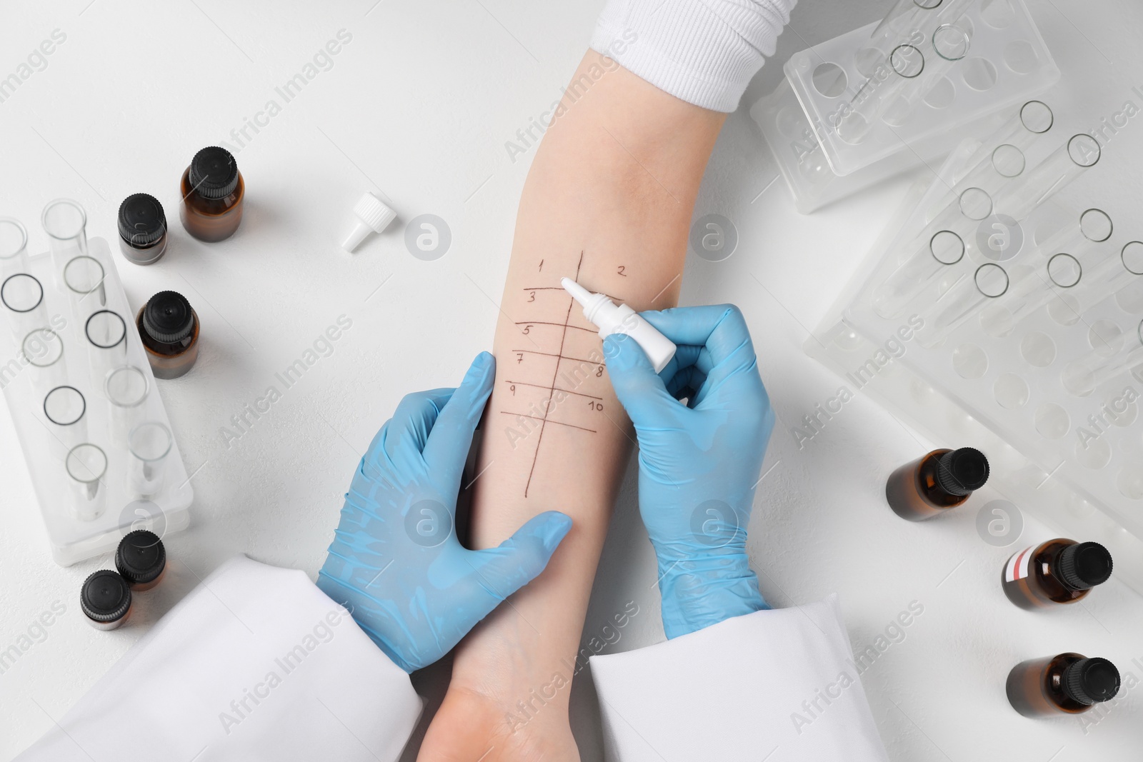 Photo of Doctor doing skin allergy test at light table, top view