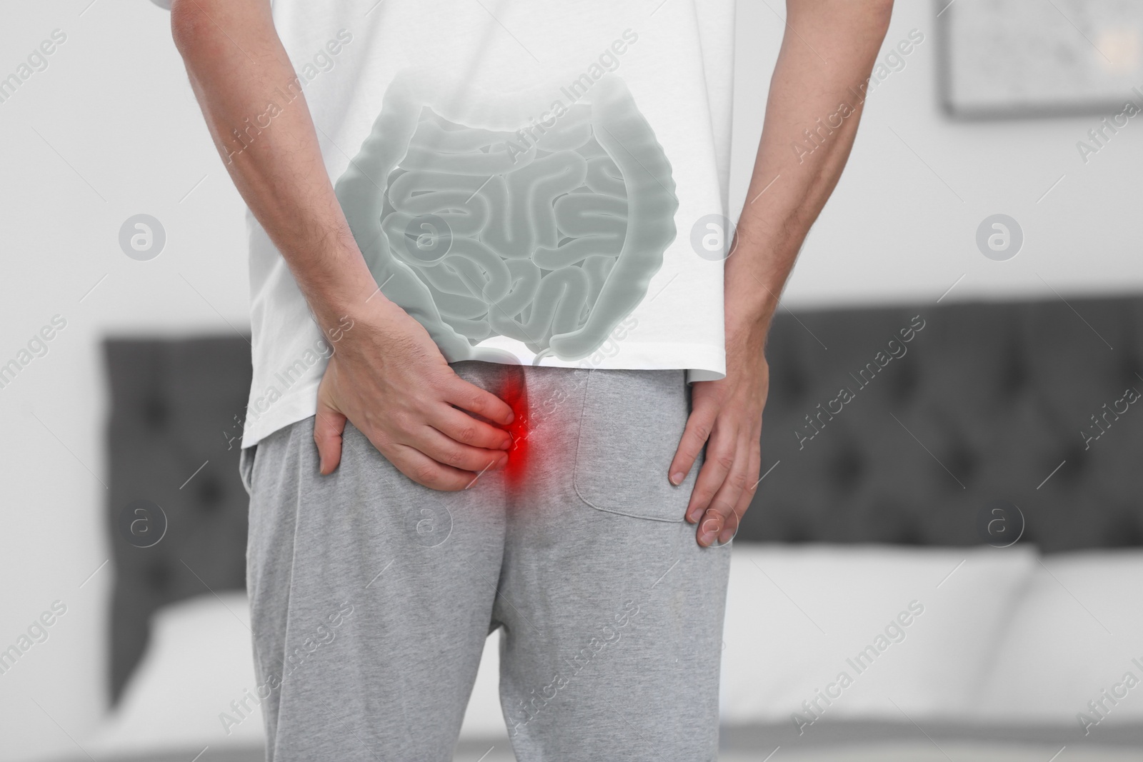 Image of Man suffering from hemorrhoid at home, closeup. Unhealthy bowel illustration