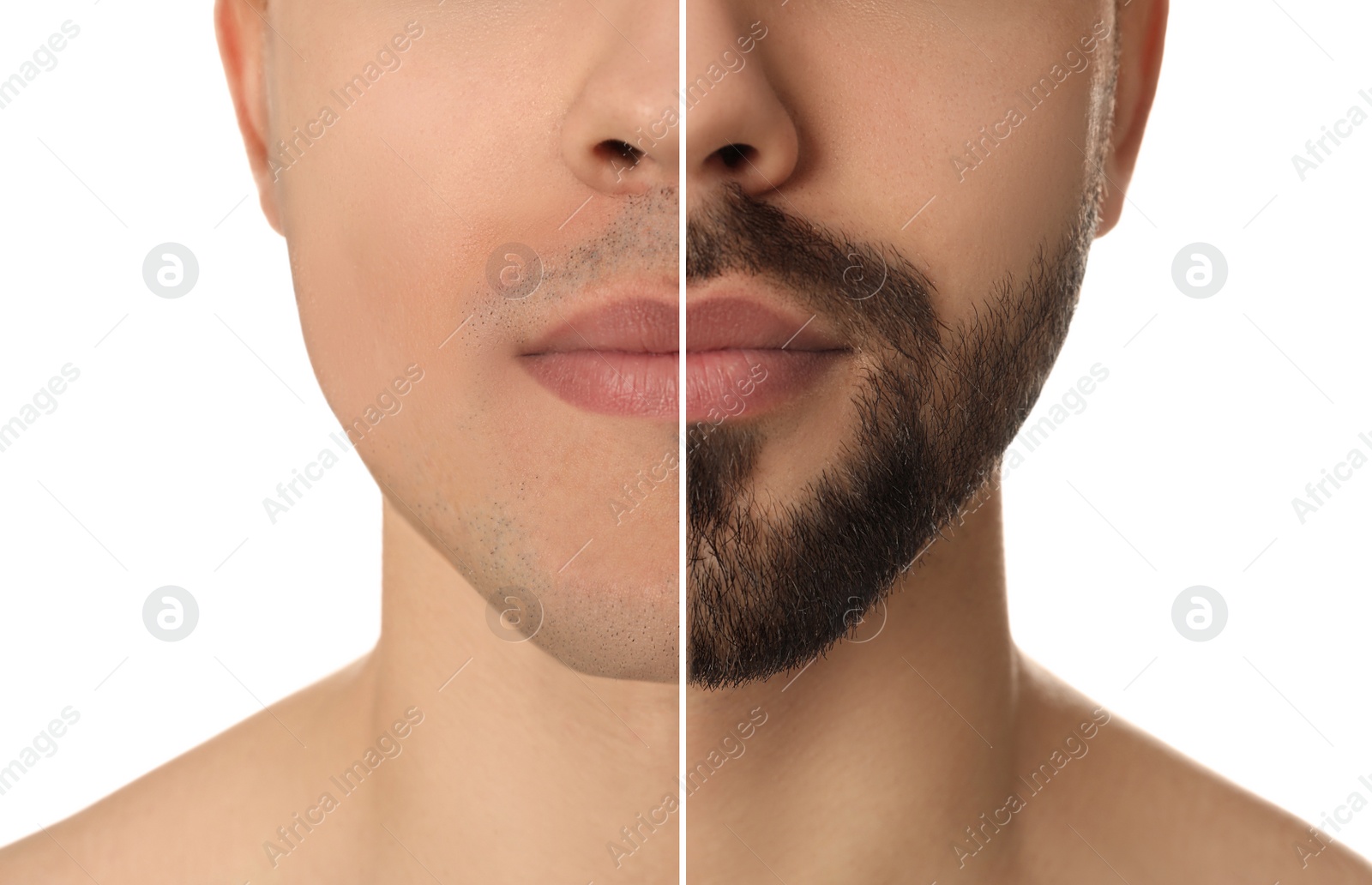 Image of Collage with photos of handsome man before and after shaving on white background, closeup 