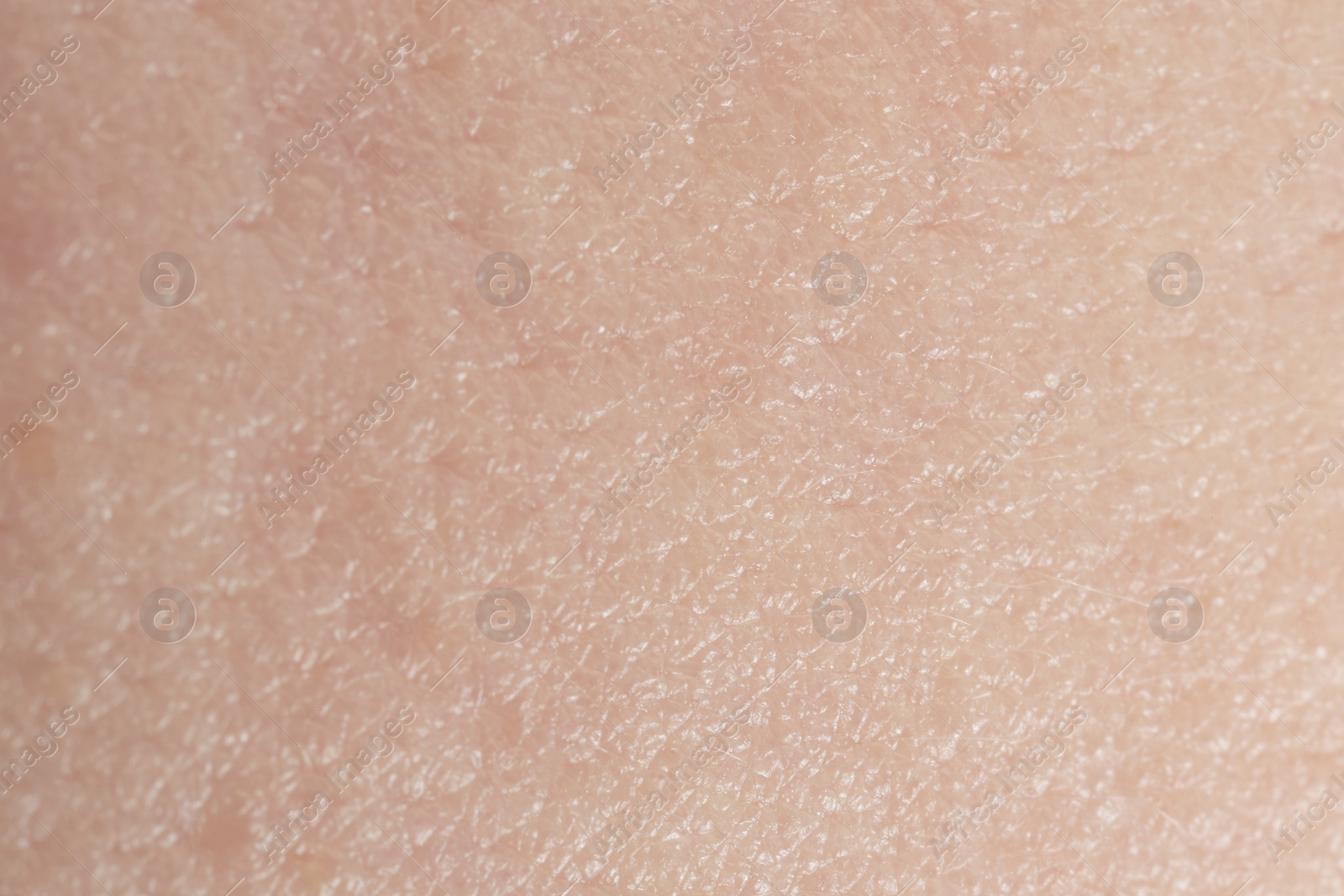 Photo of Texture of dry skin as background, macro view