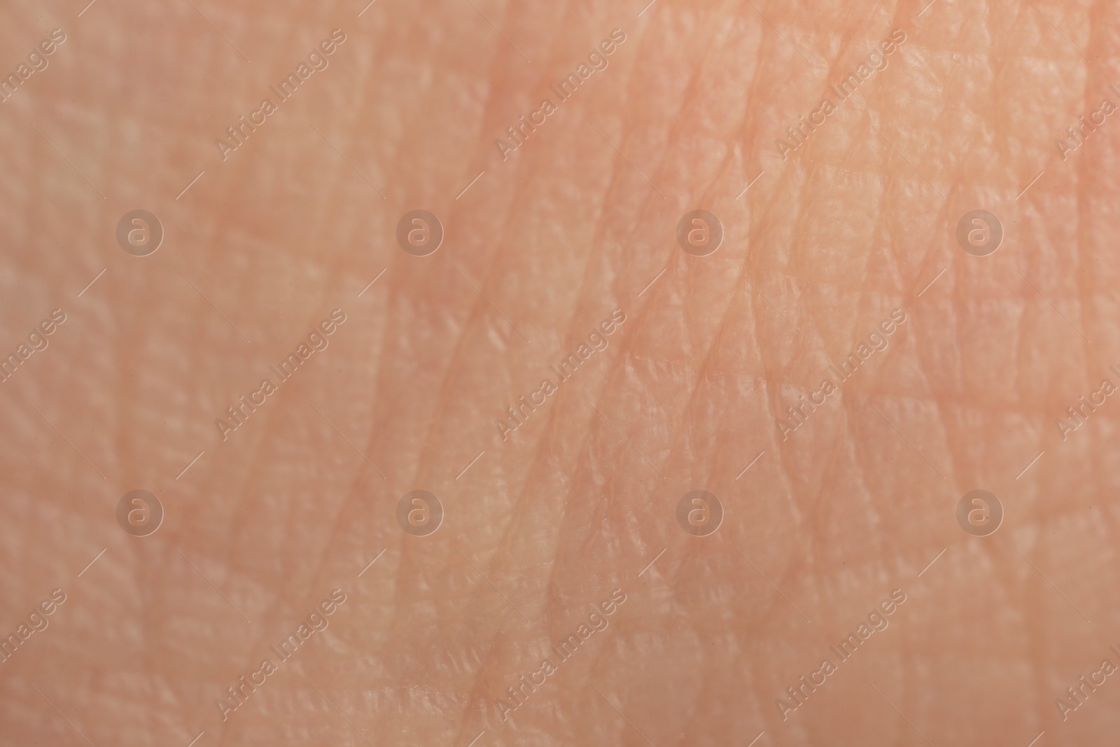 Photo of Texture of dry skin as background, macro view