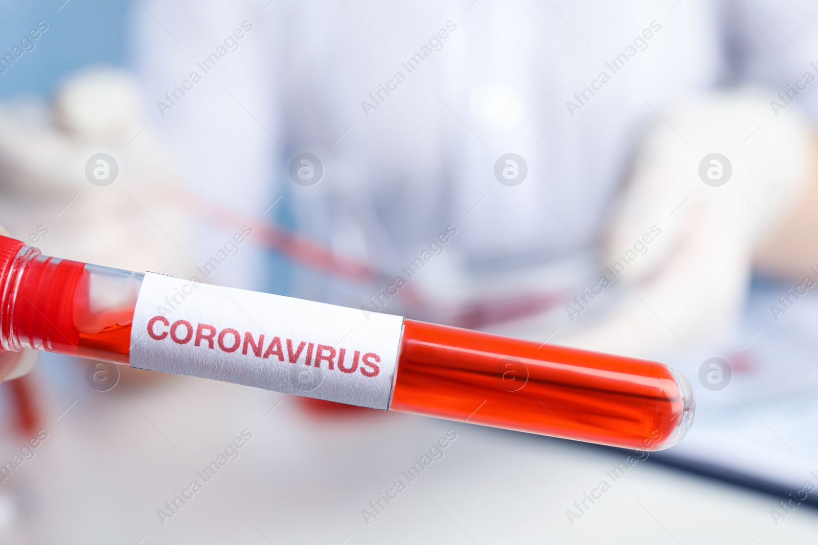 Photo of Test tube with blood sample and label CORONA VIRUS in laboratory, closeup