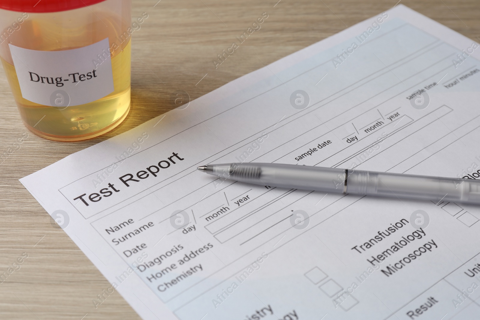 Photo of Drug test result form, container with urine sample and pen on wooden table, closeup