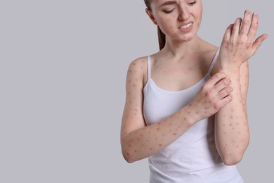 Photo of Woman with rash suffering from monkeypox virus on light grey background, closeup. Space for text
