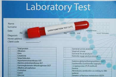 Liver Function Test. Tube with blood sample on laboratory form, top view