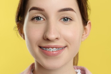 Portrait of smiling woman with dental braces on yellow background, closeup