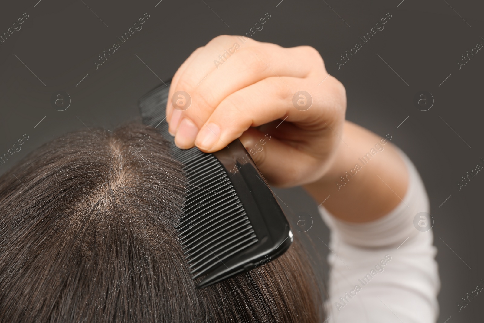 Photo of Woman with comb and dandruff in her dark hair on grey background, closeup