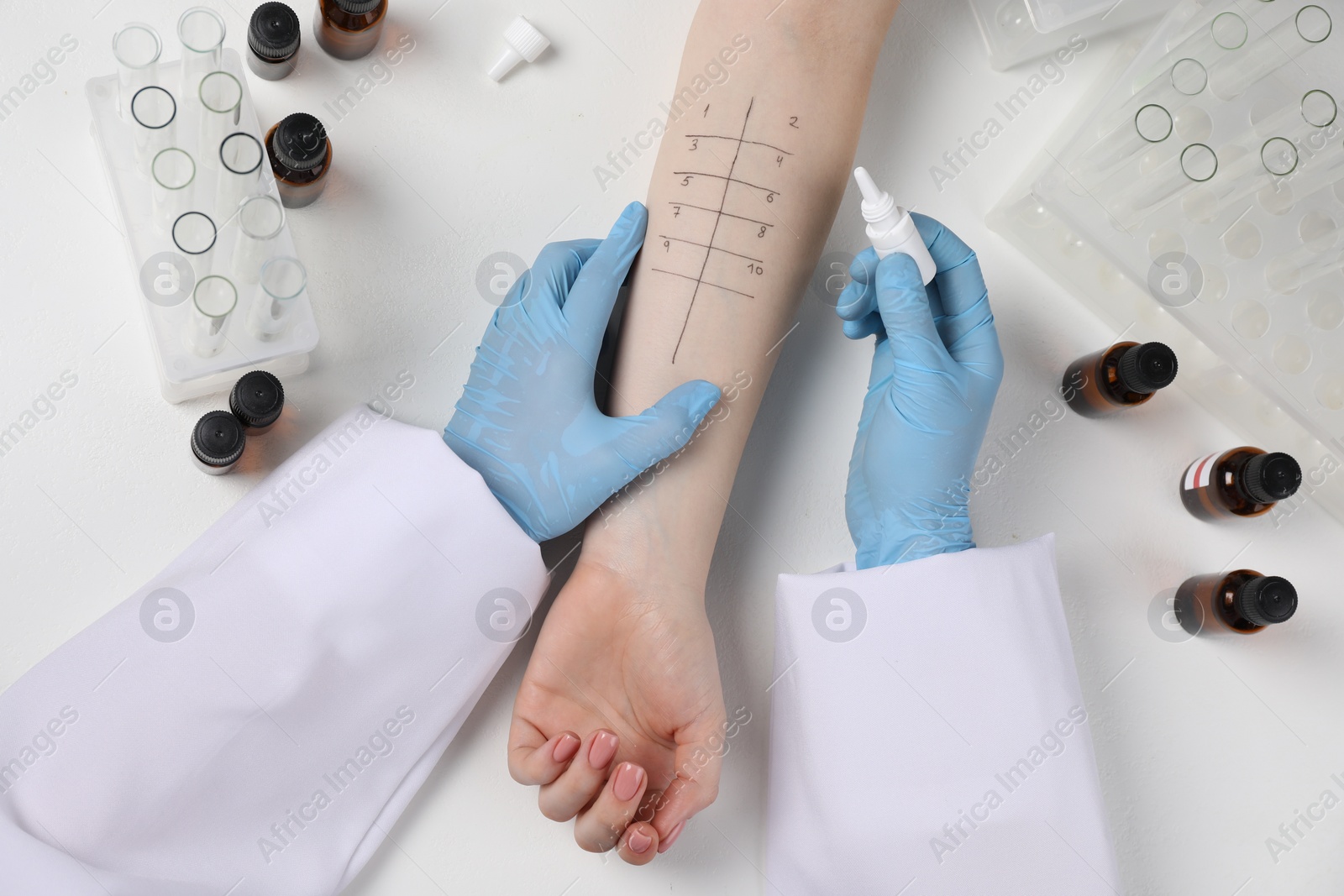 Photo of Doctor doing skin allergy test at light table, top view