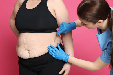 Doctor with scalpel near obese woman on pink background. Weight loss surgery