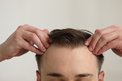 Photo of Baldness concept. Man with receding hairline indoors, closeup