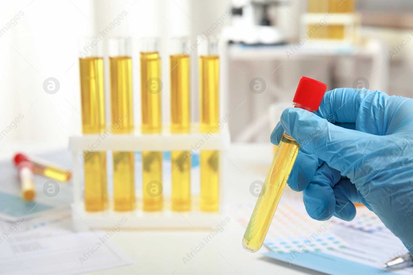 Photo of Doctor holding test tube with urine sample for analysis, closeup