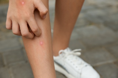 Photo of Girl scratching leg with insect bite outdoors, closeup