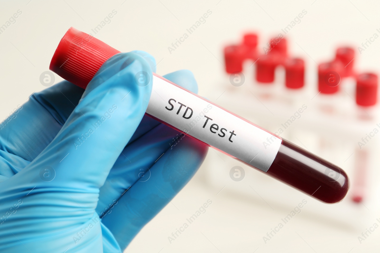 Photo of Scientist holding tube with blood sample and label STD Test on blurred background, closeup