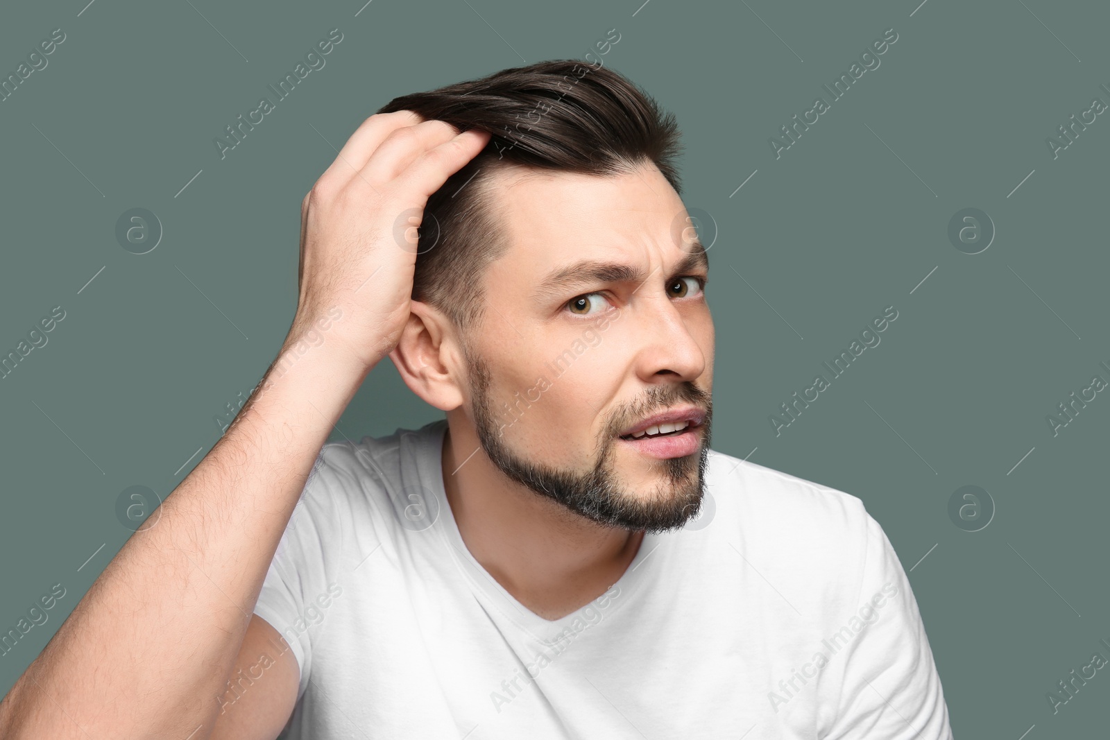 Photo of Young man with hair loss problem on color background