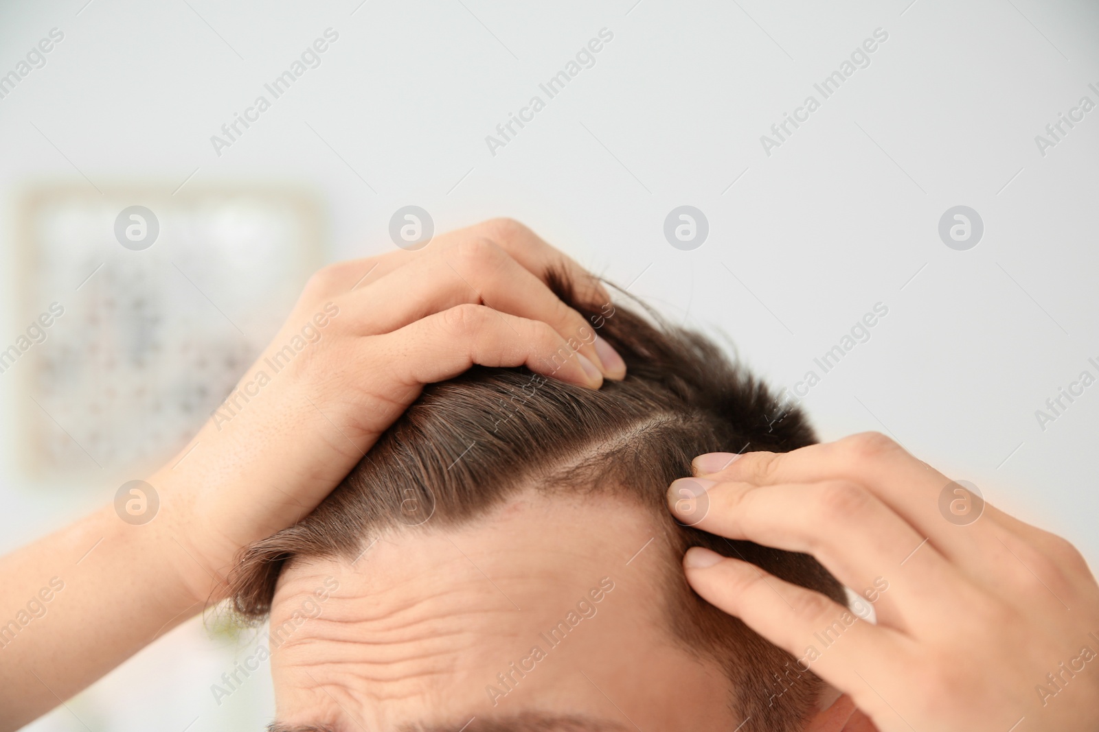 Photo of Young man with hair loss problem indoors