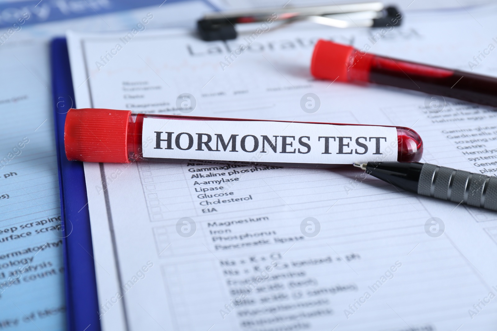 Photo of Hormones test. Sample tube with blood on laboratory forms