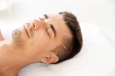 Photo of Young man undergoing acupuncture treatment in salon