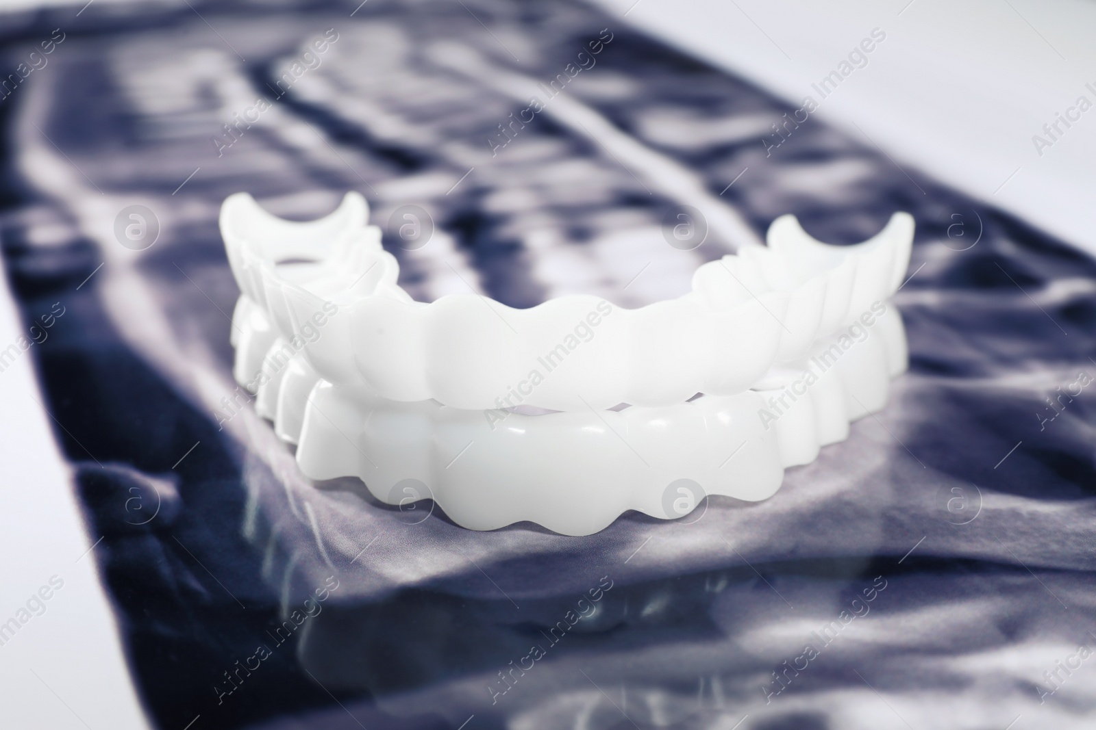 Photo of Mouth guards on dental scan, closeup. Bite correction