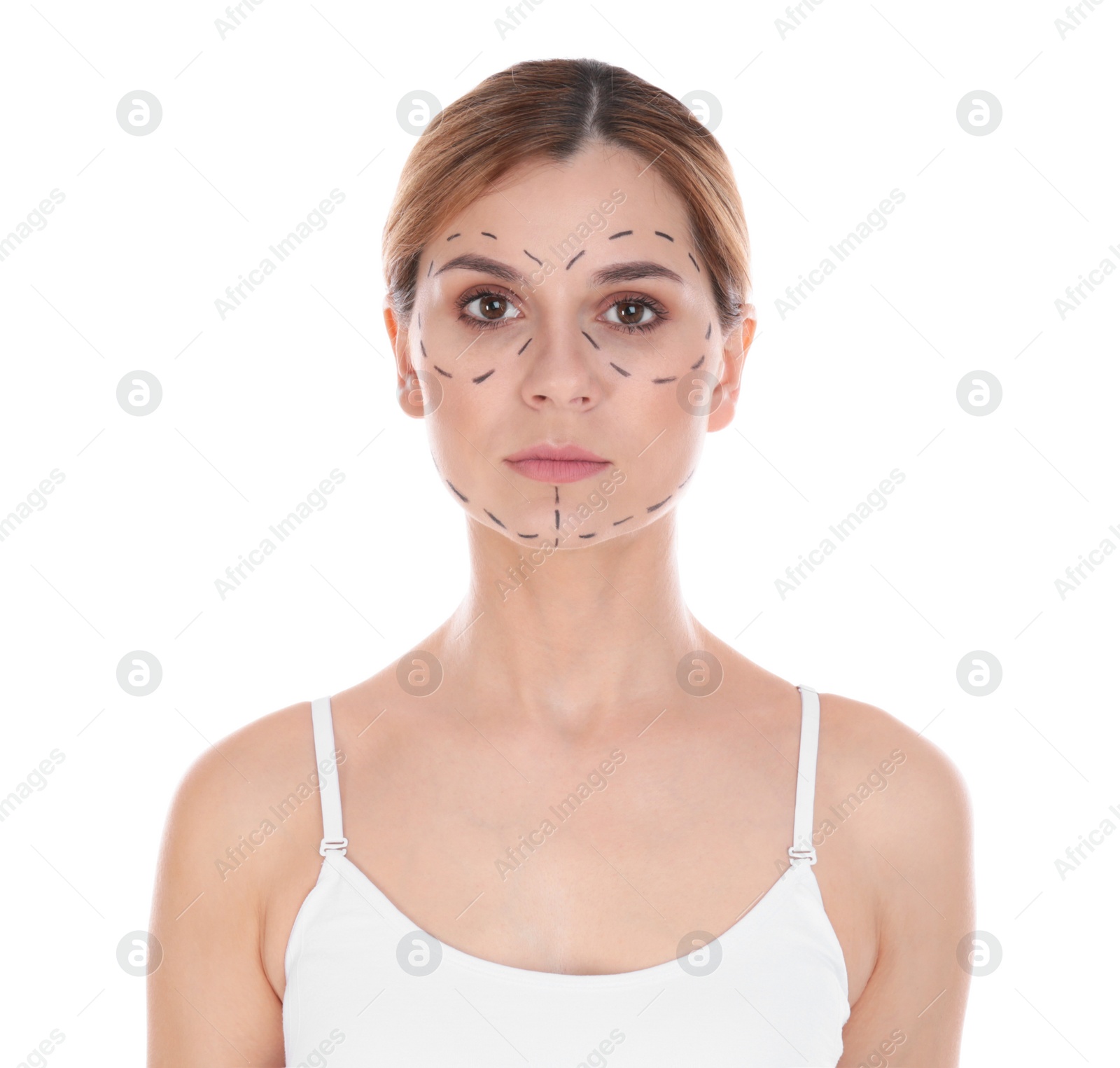 Photo of Portrait of woman with marks on face for cosmetic surgery operation against white background