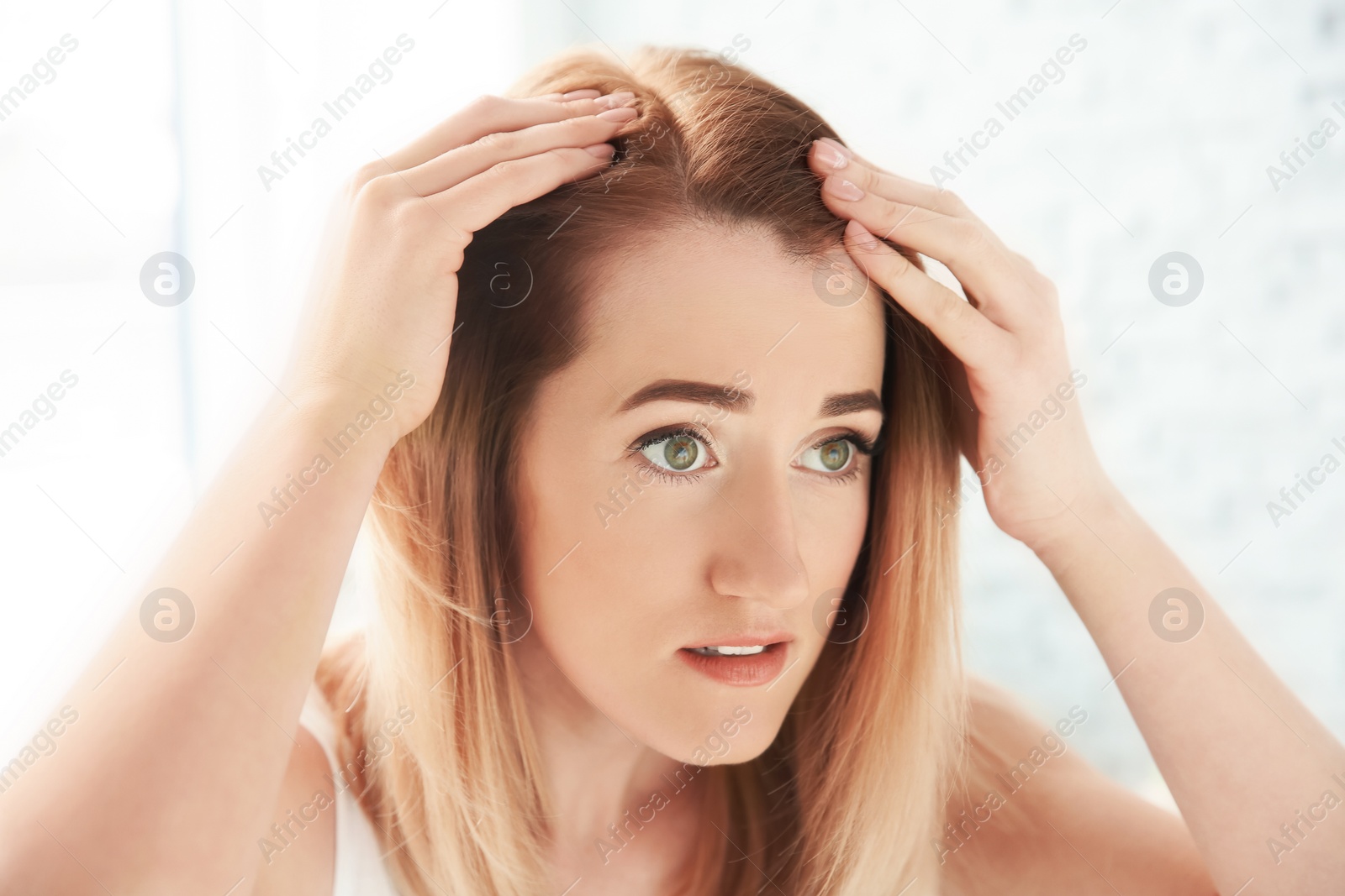 Photo of Young woman with hair loss problem at home