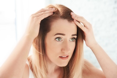 Photo of Young woman with hair loss problem at home