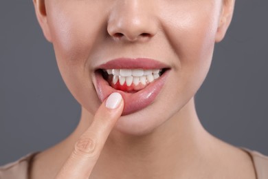 Young woman showing inflamed gums on grey background, closeup