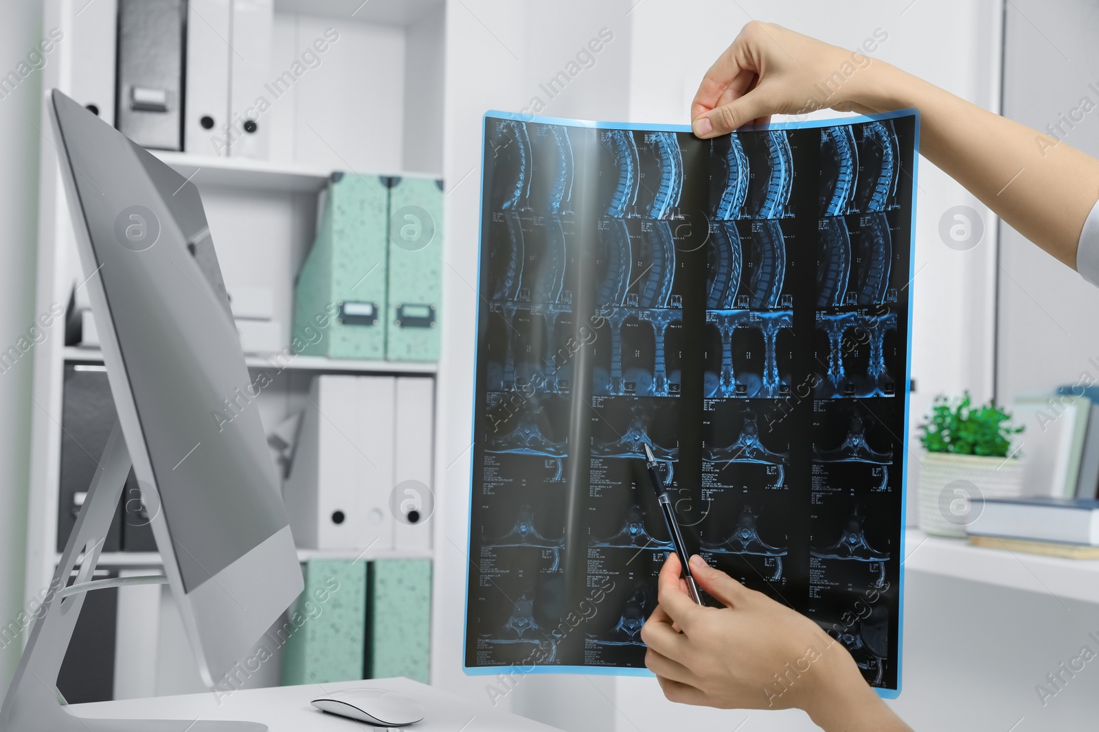 Photo of Doctor examining neck MRI image in clinic, closeup