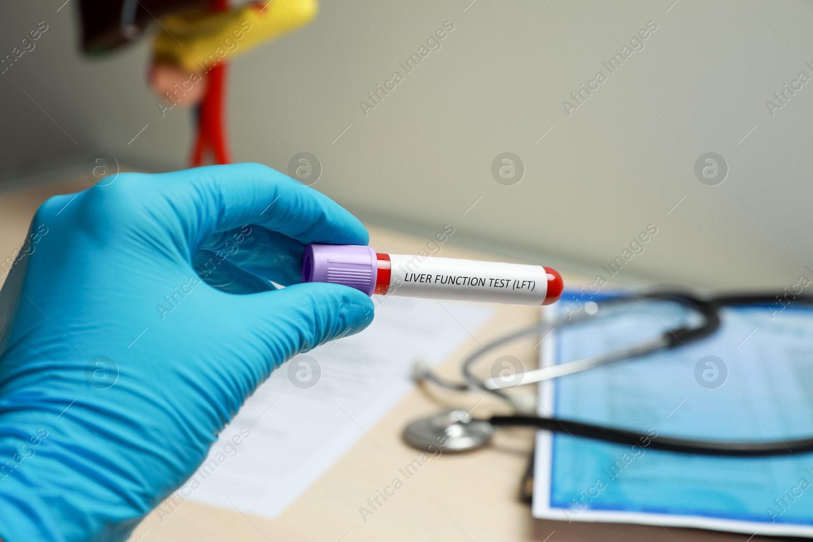 Photo of Laboratory worker holding tube with blood sample and label Liver Function Test over table, closeup