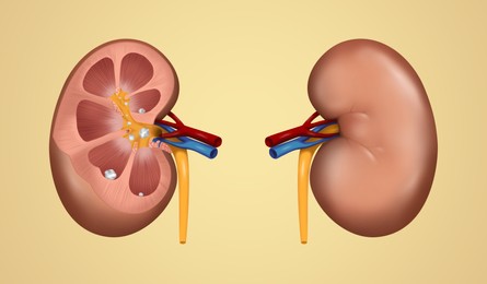 Illustration of human kidney stones on beige background. Banner design