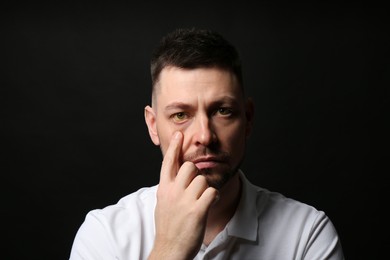 Photo of Man checking his health condition on black background. Yellow eyes as symptom of problems with liver